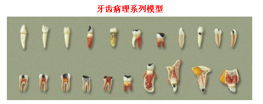 牙齿病理系列模型