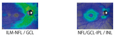blob.png