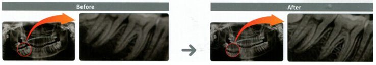 blob.png