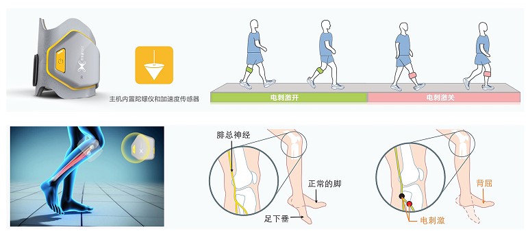 足下垂助行仪低频电子脉冲刺激仪