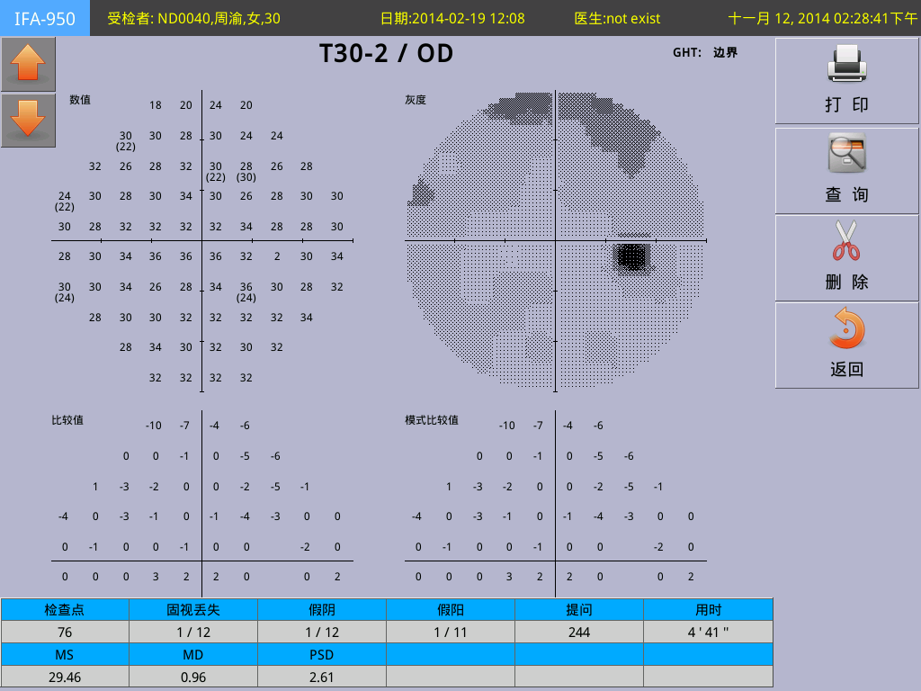 eyemove2