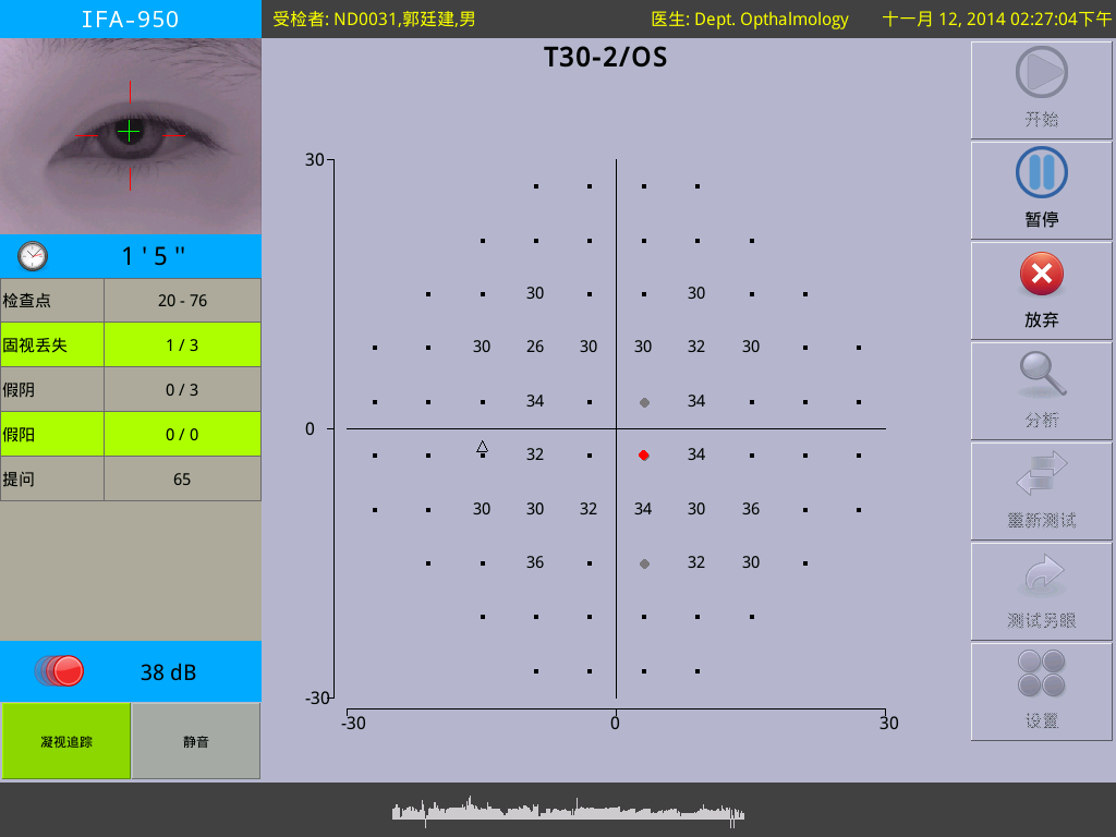 ui1