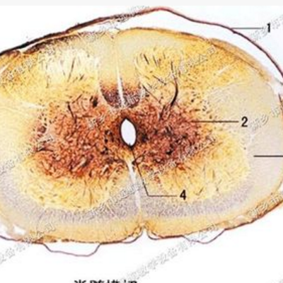 脊髓横切面图片
